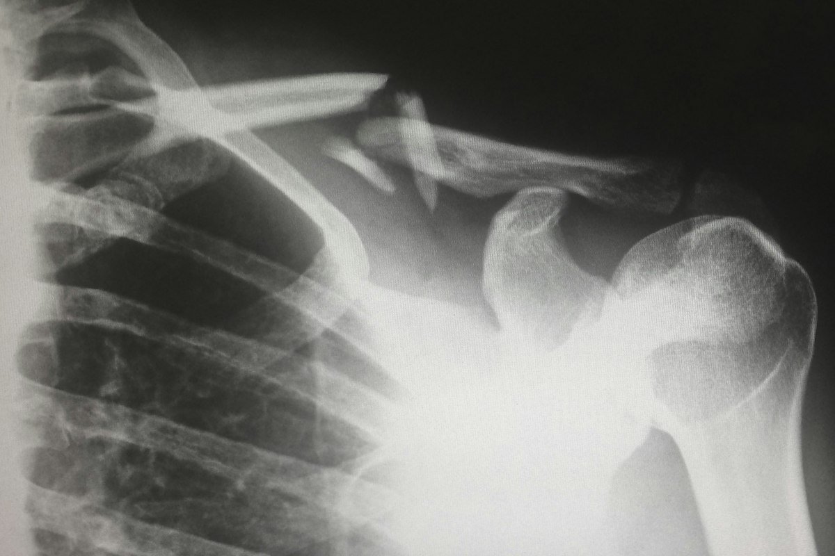 Tomografia Computadorizada na Clínica TopMedic em Nova Iguaçu