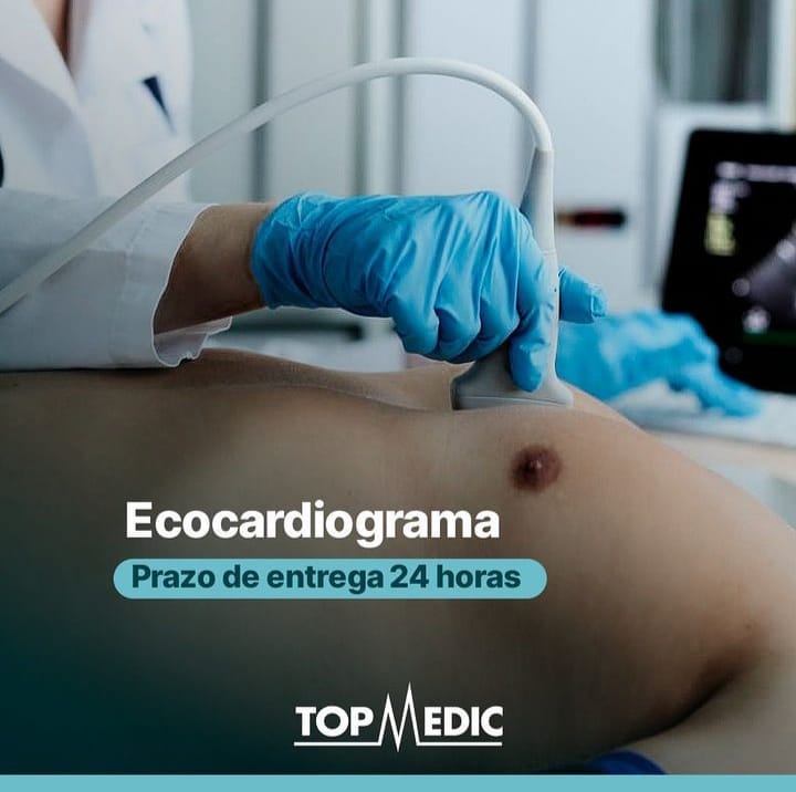 Ecocardiograma