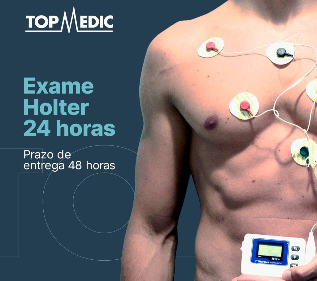 Holter 24 horas